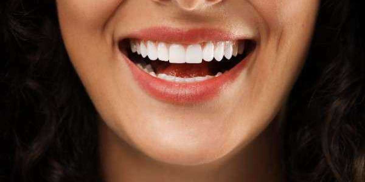 Easy and Effective Smile Support in Oldham