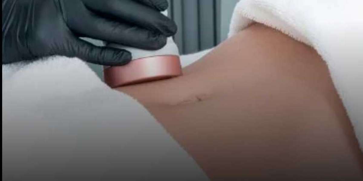 Vaser Liposuction in Dubai Comfort, Safety, and Care